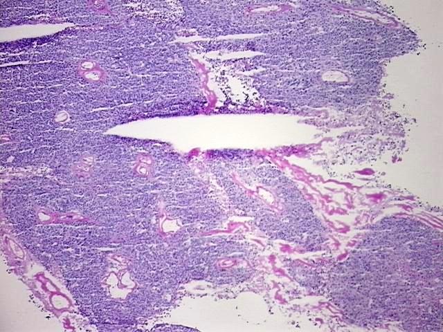 Tissue Protein Lysate, Ovary: right