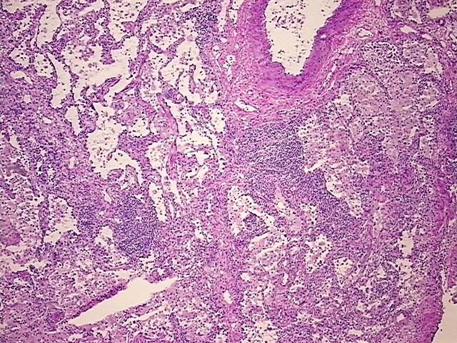Tissue Protein Lysate, Lung