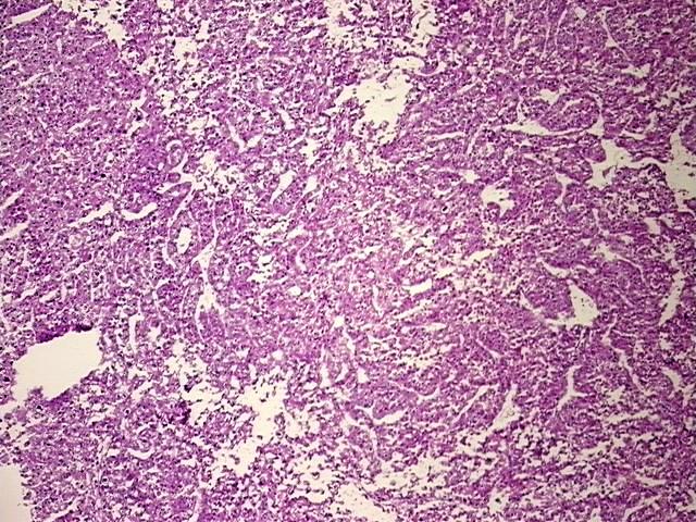Tissue Protein Lysate, Liver