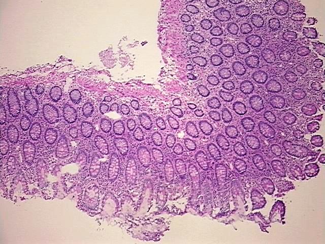 Tissue Protein Lysate, Colon: right