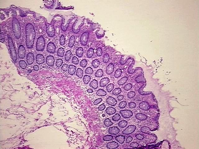 Tissue Protein Lysate, Colon: sigmoid