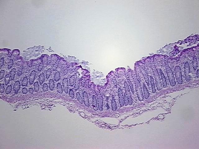 Tissue Protein Lysate, Colon: sigmoid