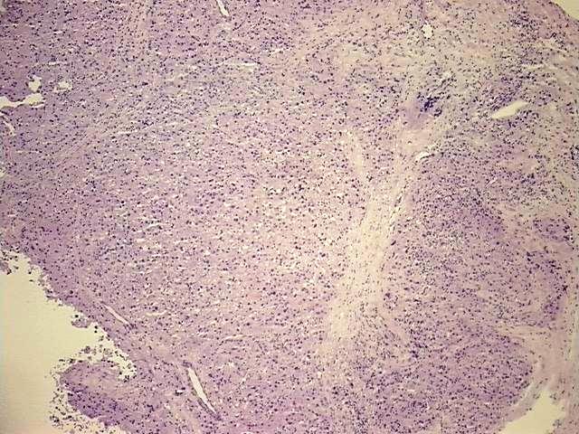 Tissue Protein Lysate, Liver