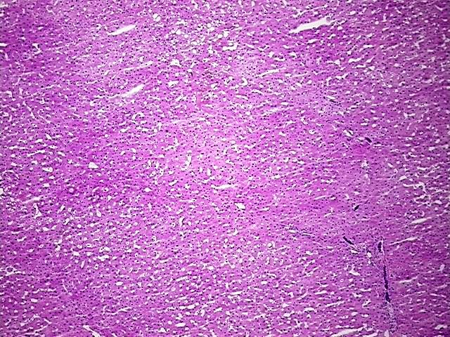 Tissue Protein Lysate, Liver
