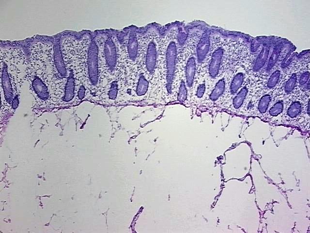4x Image