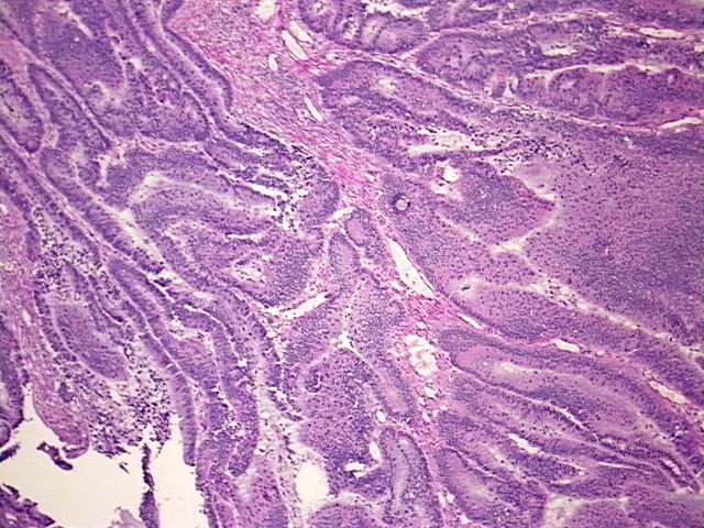 Tissue Protein Lysate, Colon: sigmoid