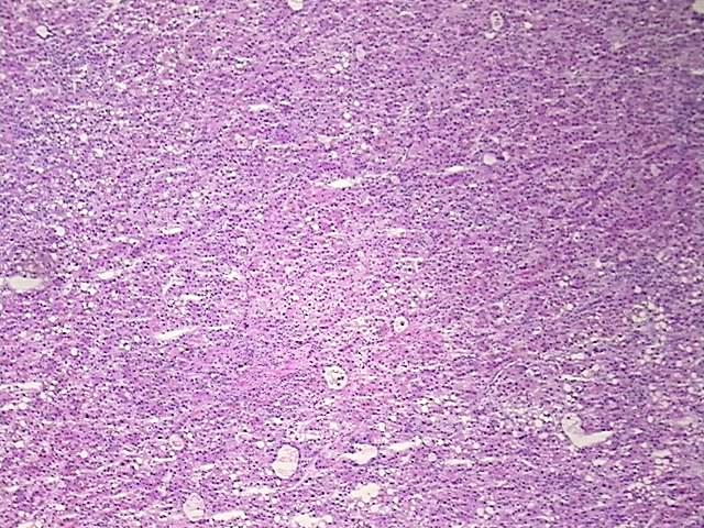 Tissue Protein Lysate, Liver