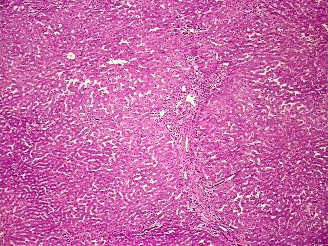 Tissue Protein Lysate, Liver