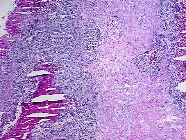 4x Image
