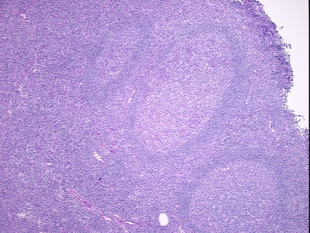 4x Image