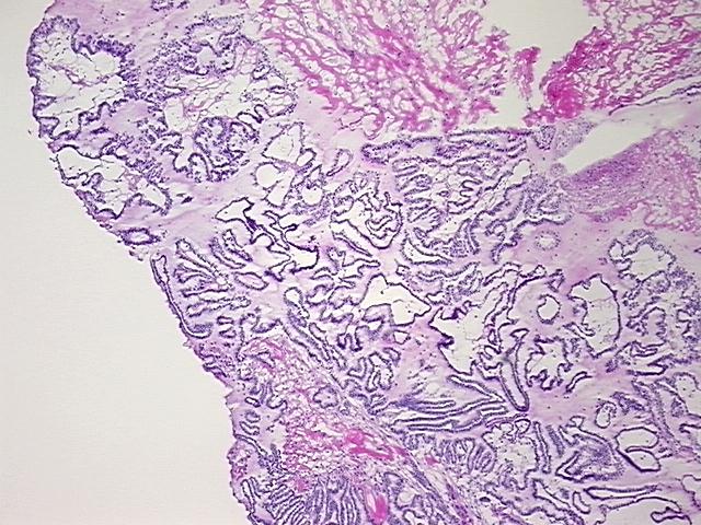 4x Image