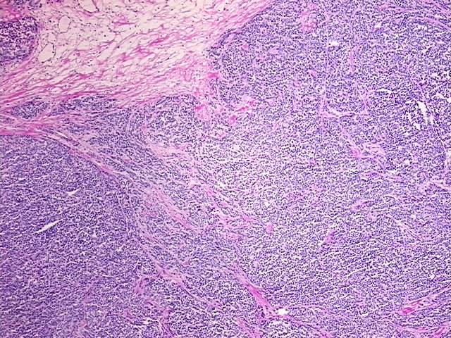 Tissue Protein Lysate, Breast