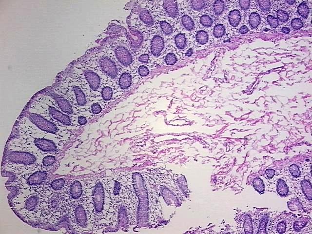 Tissue Protein Lysate, Colon: right