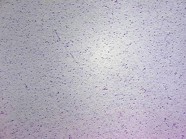 Tissue Total RNA, Soft tissue - image 1