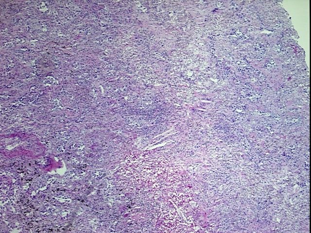 Frozen OCT-embedded Tissue - 4x.