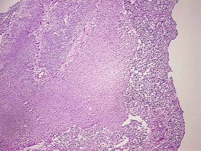 Frozen OCT-embedded Tissue - 4x.