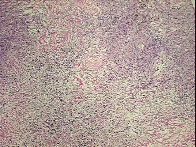 Frozen OCT-embedded Tissue - 4x.