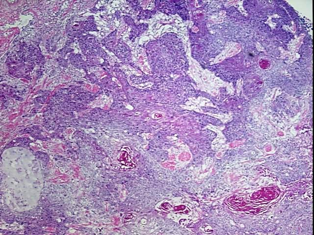 Frozen OCT-embedded Tissue - 4x.