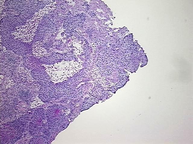 Frozen Tissue Sections, Lung: left upper lobe | OriGene Technologies Inc.