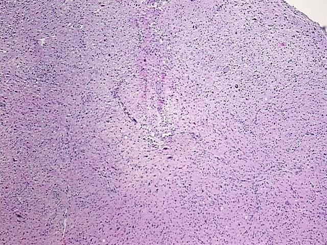 Tissue FFPE Sections, Brain | CS714449 | OriGene Technologies Inc.