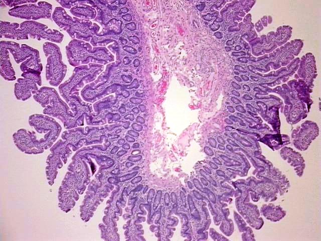 Tissue FFPE Sections, Small intestine