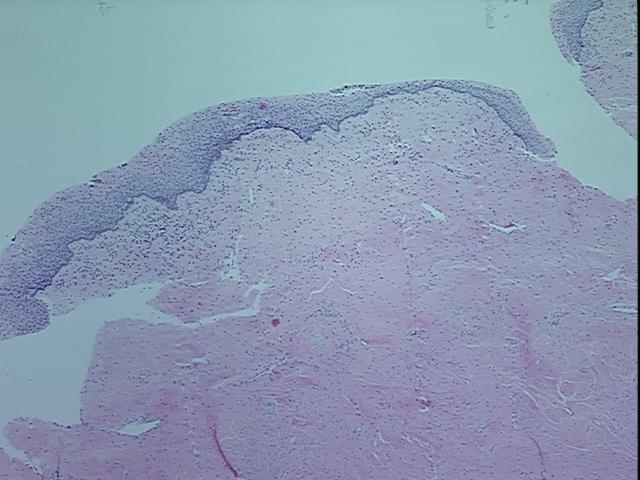 4x Image