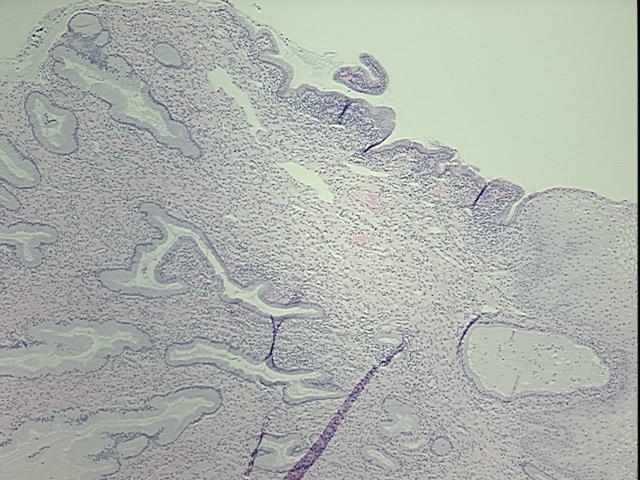 4x Image