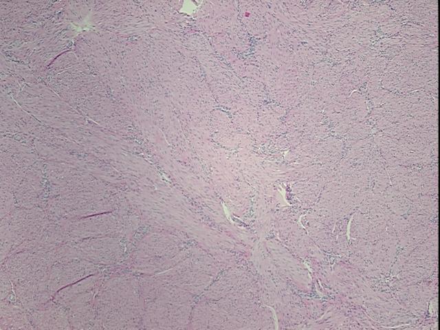 4x Image