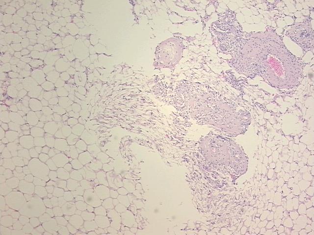 4x Image