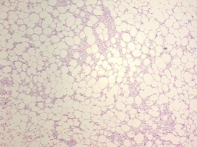 Tissue FFPE Sections, Kidney