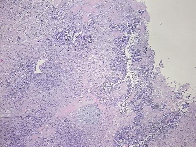 4x Image