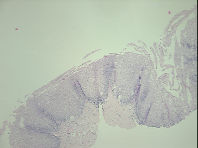 4x Image