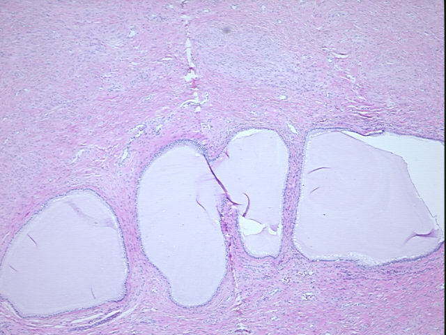4x Image