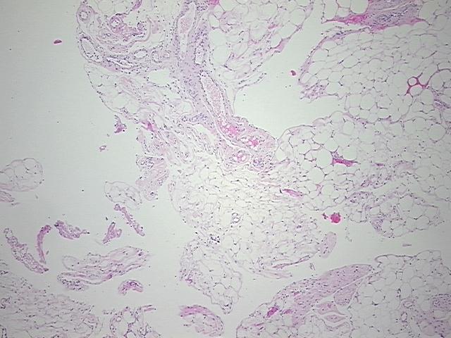 4x Image