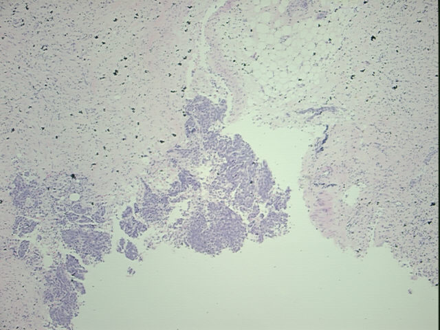 4x Image