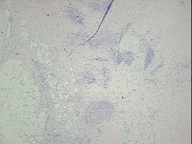 4x Image