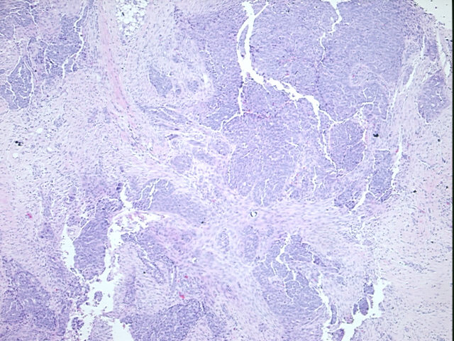 4x Image