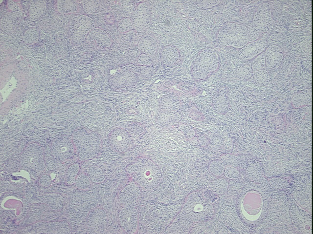 4x Image