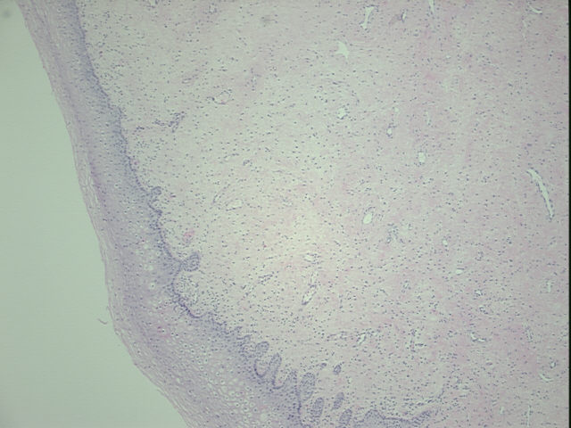 4x Image