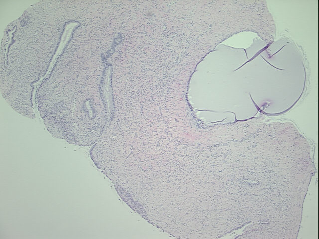 4x Image
