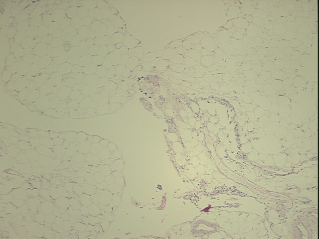 4x Image