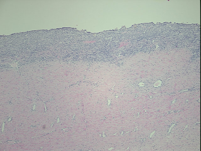 4x Image