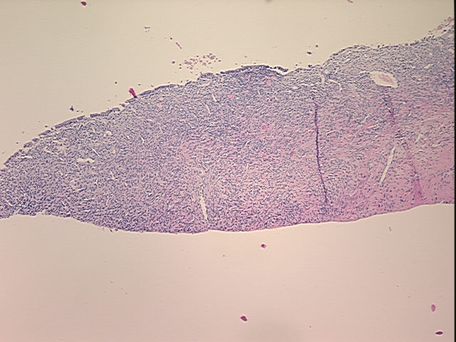 4x Image