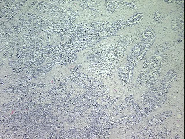 4x Image