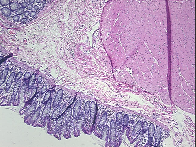 4x Image