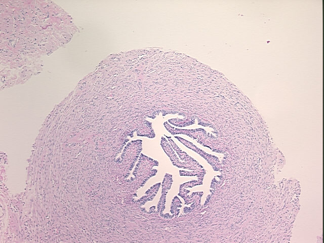4x Image