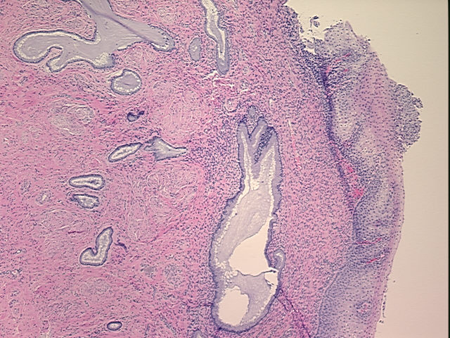 4x Image