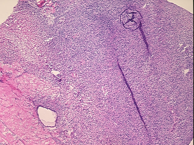4x Image