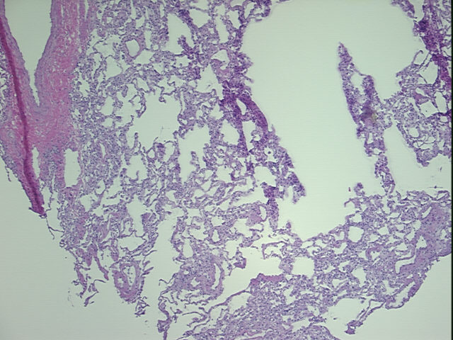 4x Image