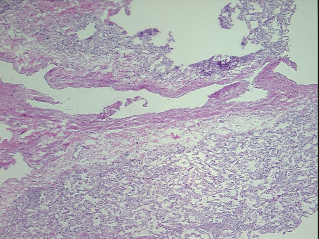 4x Image